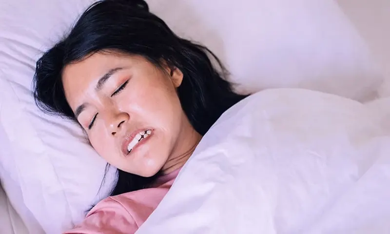 Ilustrasi bruxism (Foto: mdperio.com)