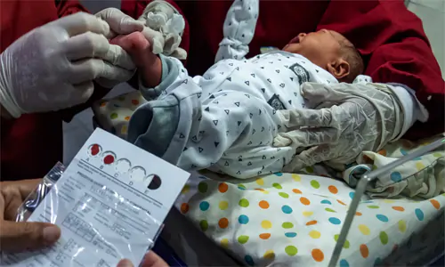 1,2 Juta Bayi Jalani Skrining Hipotiroid Kongenital, Apa Itu?